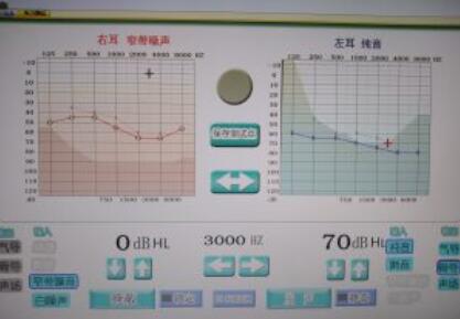 助听器是生活好帮手 惠州刘大姐验配助听器(图1)