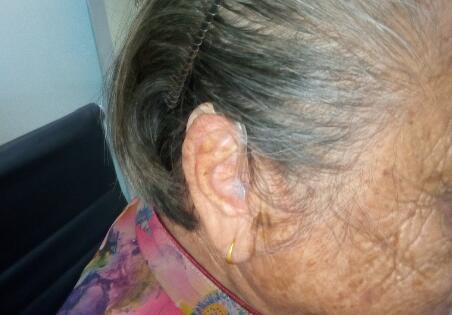 惠州博罗80岁退休阿姨双耳验配定制型助听器
