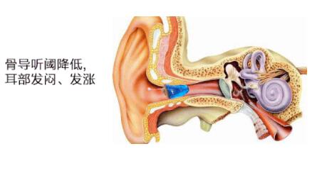 戴助听器感觉很闷,怎么办?(图1)