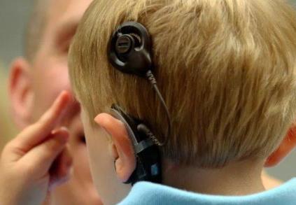 人工耳蜗和和助听器怎么搭配？