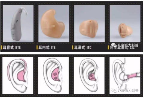助听器是什么？如何给宝宝选择适合的助听器？(图2)