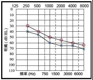 听力测试结果